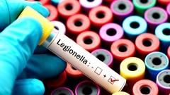 Zapobieganie zakażeniom bakteriami z rodzaju Legionella – zalecenia Głównego Inspektora Sanitarnego.